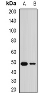 CCM2 / Malcavernin Antibody - Western blot analysis of Malcavernin expression in mouse brain (A); mouse testis (B) whole cell lysates.