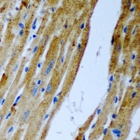 CCM2 / Malcavernin Antibody - Immunohistochemical analysis of Malcavernin staining in rat heart formalin fixed paraffin embedded tissue section. The section was pre-treated using heat mediated antigen retrieval with sodium citrate buffer (pH 6.0). The section was then incubated with the antibody at room temperature and detected using an HRP conjugated compact polymer system. DAB was used as the chromogen. The section was then counterstained with hematoxylin and mounted with DPX.