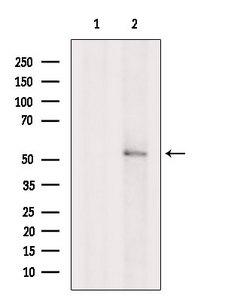 CCM2 / Malcavernin Antibody