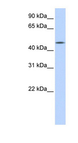 CCM2L Antibody - C20orf160 antibody Western blot of Transfected 293T cell lysate. This image was taken for the unconjugated form of this product. Other forms have not been tested.