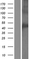 CCM2L Protein - Western validation with an anti-DDK antibody * L: Control HEK293 lysate R: Over-expression lysate