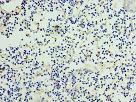 CCN3 / NOV Antibody - Immunohistochemistry of paraffin-embedded human thymus using antibody at 1:100 dilution.