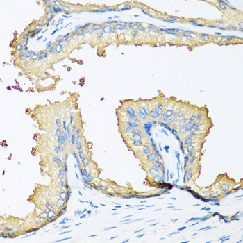 CCN3 / NOV Antibody - Immunohistochemistry of paraffin-embedded human prostate.