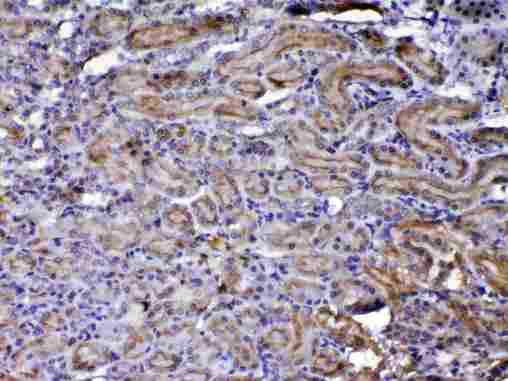 CCN3 / NOV Antibody - IHC analysis of NOV/CCN3 using anti-NOV/CCN3 antibody. NOV/CCN3 was detected in paraffin-embedded section of rat kidney tissue . Heat mediated antigen retrieval was performed in citrate buffer (pH6, epitope retrieval solution) for 20 mins. The tissue section was blocked with 10% goat serum. The tissue section was then incubated with 1µg/ml rabbit anti-NOV/CCN3 Antibody overnight at 4°C. Biotinylated goat anti-rabbit IgG was used as secondary antibody and incubated for 30 minutes at 37°C. The tissue section was developed using Strepavidin-Biotin-Complex (SABC) with DAB as the chromogen.