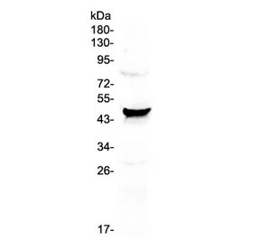 CCN3 / NOV Antibody - Western blot testing of human HeLa cell lysate with CCN3 antibody at 0.5ug/ml. Observed molecular weight: ~47 kDa (full), ~35 kDa (cleaved).