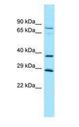 CCN4 / WISP1 Antibody - CCN4 / WISP1 antibody Western Blot of 721_B.  This image was taken for the unconjugated form of this product. Other forms have not been tested.