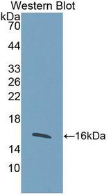 CCN4 / WISP1 Antibody - Western blot of CCN4 / WISP1 antibody.