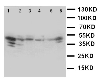 CCN4 / WISP1 Antibody - WB of CCN4 / WISP1 antibody. Lane 1: Rat Heart Tissue Lysate. Lane 2: Rat Kidney Tissue Lysate. Lane 3: Rat Lung Tissue Lysate. Lane 4: A549 Cell Lysate. Lane 5: A431 Cell Lysate. Lane 6: COLO320 Cell Lysate..