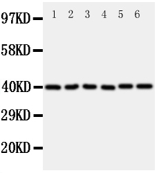 CCN4 / WISP1 Antibody - Anti-WISP1 antibody, Western blotting All lanes: Anti WISP1 at 0.5ug/ml Lane 1: Rat Heart Tissue Lysate at 50ugLane 2: Rat Kidney Tissue Lysate at 50ugLane 3: Rat Lung Tissue Lysate at 50ugLane 4: A549 Whole Cell Lysate at 40ugLane 5: A431 Whole Cell Lysate at 40ugLane 6: COLO320 Whole Cell Lysate at 40ugPredicted bind size: 40KD Observed bind size: 40KD