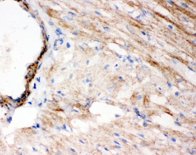 CCN4 / WISP1 Antibody - IHC analysis of WISP1 using anti-WISP1 antibody. WISP1 was detected in frozen section of rat cardiac muscle tissues. Heat mediated antigen retrieval was performed in citrate buffer (pH6, epitope retrieval solution) for 20 mins. The tissue section was blocked with 10% goat serum. The tissue section was then incubated with 1µg/ml rabbit anti-WISP1 Antibody overnight at 4°C. Biotinylated goat anti-rabbit IgG was used as secondary antibody and incubated for 30 minutes at 37°C. The tissue section was developed using Strepavidin-Biotin-Complex (SABC) with DAB as the chromogen.