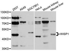 CCN4 / WISP1 Antibody - Western blot analysis of extracts of various cell lines.