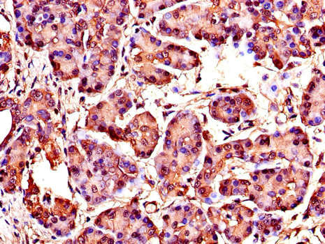 CCN4 / WISP1 Antibody - Immunohistochemistry of paraffin-embedded human pancreatic tissue using WISP1 Antibody at dilution of 1:100