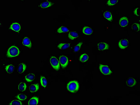 CCN4 / WISP1 Antibody - Immunofluorescent analysis of A549 cells using WISP1 Antibody at a dilution of 1:100 and Alexa Fluor 488-congugated AffiniPure Goat Anti-Rabbit IgG(H+L)