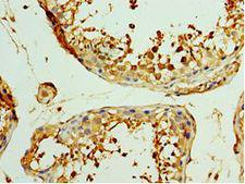 CCN5 Antibody - Immunohistochemistry of paraffin-embedded human testicle using antibody at 1:100 dilution.