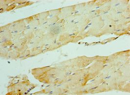 CCN5 Antibody - Immunohistochemistry of paraffin-embedded human skeletal muscle using antibody at 1:100 dilution.