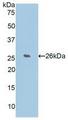 CCN5 Antibody - Western Blot; Sample: Recombinant WISP2, Human.