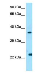 CCN5 Antibody - WISP2 antibody Western Blot of Human Placenta.  This image was taken for the unconjugated form of this product. Other forms have not been tested.