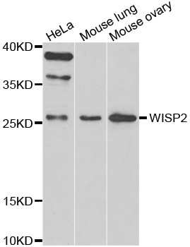 CCN5 Antibody - Western blot analysis of extracts of various cell lines.