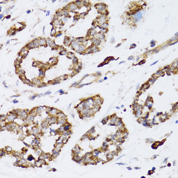 CCN5 Antibody - Immunohistochemistry of paraffin-embedded mouse esophageal cancer tissue.