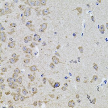 CCN5 Antibody - Immunohistochemistry of paraffin-embedded mouse brain using WISP2 antibody at dilution of 1:100 (40x lens).