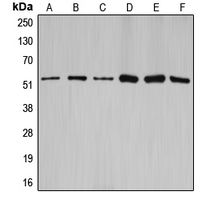 CCNA1/CCNA2 Antibody - Western blot analysis of Cyclin A1/2 expression in HEK293T (A); NIH3T3 (B); rat brain (C); SW626 (D); SKOV3 (E); A2780 (F) whole cell lysates.