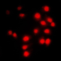 CCNA1/CCNA2 Antibody - Immunofluorescent analysis of Cyclin A1/2 staining in NIH3T3 cells. Formalin-fixed cells were permeabilized with 0.1% Triton X-100 in TBS for 5-10 minutes and blocked with 3% BSA-PBS for 30 minutes at room temperature. Cells were probed with the primary antibody in 3% BSA-PBS and incubated overnight at 4 C in a humidified chamber. Cells were washed with PBST and incubated with a DyLight 594-conjugated secondary antibody (red) in PBS at room temperature in the dark. DAPI was used to stain the cell nuclei (blue).