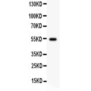 CCNA1 / Cyclin A1 Antibody - Cyclin A1 antibody Western blot. All lanes: Anti Cyclin A1 at 0.5 ug/ml. WB: Human Placenta Tissue Lysate at 50 ug. Predicted band size: 52 kD. Observed band size: 52 kD.
