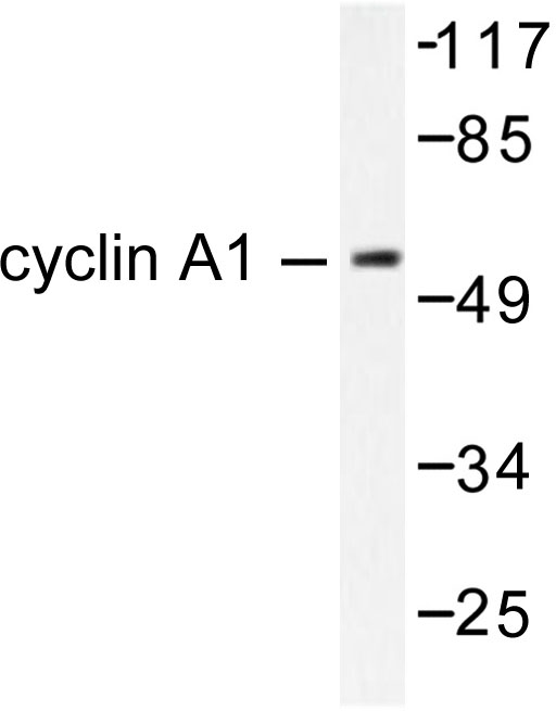 CCNA1 / Cyclin A1 Antibody - Western blot of Cyclin A1 (R436) pAb in extracts from SKOV3 cells treated with Heat shock.