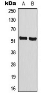 CCNA1 / Cyclin A1 Antibody - Western blot analysis of Cyclin A1 expression in MCF7 (A); NIH3T3 (B) whole cell lysates.