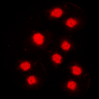 CCNA1 / Cyclin A1 Antibody - Immunofluorescent analysis of Cyclin A1 staining in MCF7 cells. Formalin-fixed cells were permeabilized with 0.1% Triton X-100 in TBS for 5-10 minutes and blocked with 3% BSA-PBS for 30 minutes at room temperature. Cells were probed with the primary antibody in 3% BSA-PBS and incubated overnight at 4 C in a humidified chamber. Cells were washed with PBST and incubated with a DyLight 594-conjugated secondary antibody (red) in PBS at room temperature in the dark. DAPI was used to stain the cell nuclei (blue).