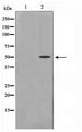 CCNA1 / Cyclin A1 Antibody - Western blot of SK-OV3 cell lysate using Cyclin A1 Antibody