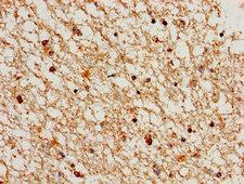 CCNA1 / Cyclin A1 Antibody - Immunohistochemistry image of paraffin-embedded human brain tissue at a dilution of 1:100