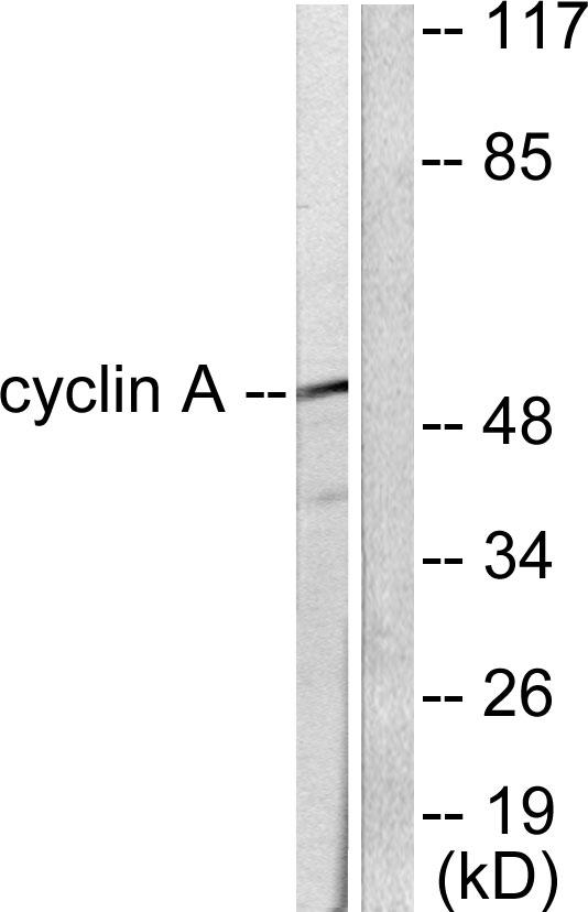CCNA1 / Cyclin A1 Antibody - Western blot analysis of extracts from COS7 cells, using Cyclin A antibody.