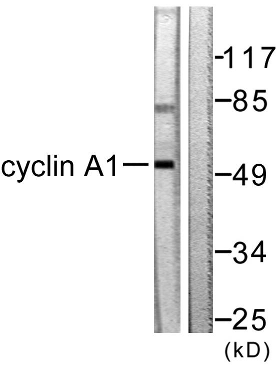 CCNA1 / Cyclin A1 Antibody - Western blot analysis of extracts from SKOV3 cells, using Cyclin A1 antibody.