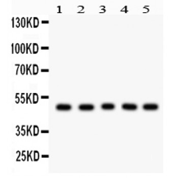 CCNA2 / Cyclin A2 Antibody - Cyclin A2 antibody Western blot. All lanes: Anti Cyclin A2 at 0.5 ug/ml. Lane 1: Rat Skeletal Muscle Tissue Lysate at 50 ug. Lane 2: HELA Whole Cell Lysate at 40 ug. Lane 3: COLO320 Whole Cell Lysate at 40 ug. Lane 4: HEPG2 Whole Cell Lysate at 40 ug. Lane 5: MCF-7 Whole Cell Lysate at 40 ug. Predicted band size: 49 kD. Observed band size: 49 kD.