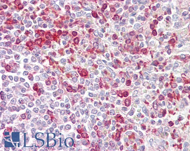 CCNA2 / Cyclin A2 Antibody - Anti-CCNA2 / Cyclin A2 antibody IHC of human spleen. Immunohistochemistry of formalin-fixed, paraffin-embedded tissue after heat-induced antigen retrieval. Antibody dilution 5-7.5 ug/ml.  This image was taken for the unconjugated form of this product. Other forms have not been tested.