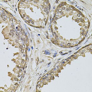 CCNA2 / Cyclin A2 Antibody - Immunohistochemistry of paraffin-embedded human prostate using CCNA2 antibody at dilution of 1:100 (40x lens).