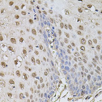 CCNA2 / Cyclin A2 Antibody - Immunohistochemistry of paraffin-embedded human esophagus using CCNA2 antibody at dilution of 1:100 (40x lens).