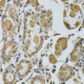CCNA2 / Cyclin A2 Antibody - Immunohistochemistry of paraffin-embedded human stomach using CCNA2 antibody at dilution of 1:100 (40x lens).