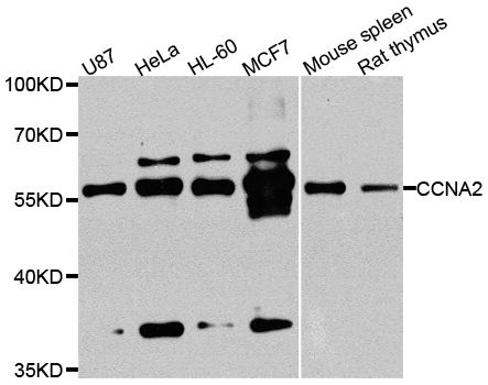 CCNA2 / Cyclin A2 Antibody - Western blot analysis of extracts of various cell lines, using CCNA2 antibody at 1:1000 dilution. The secondary antibody used was an HRP Goat Anti-Rabbit IgG (H+L) at 1:10000 dilution. Lysates were loaded 25ug per lane and 3% nonfat dry milk in TBST was used for blocking. An ECL Kit was used for detection and the exposure time was 30s.