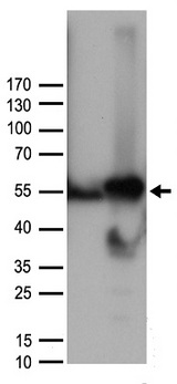 CCNA2 / Cyclin A2 Antibody - HEK293T cells were transfected with the pCMV6-ENTRY control. (Left lane) or pCMV6-ENTRY CCNA2. (Right lane) cDNA for 48 hrs and lysed