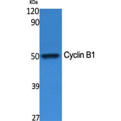 CCNB1 / Cyclin B1 Antibody - Western blot of Cyclin B1 antibody