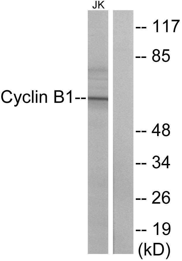 CCNB1 / Cyclin B1 Antibody - Western blot analysis of lysates from Jurkat cells, treated with UV 15', using Cyclin B1 Antibody. The lane on the right is blocked with the synthesized peptide.