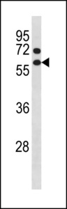 CCNB1 / Cyclin B1 Antibody - CCNB1 Antibody (Center Y177) western blot of NCI-H460 cell line lysates (35 ug/lane). The CCNB1 antibody detected the CCNB1 protein (arrow).