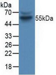 CCNB1 / Cyclin B1 Antibody - Western Blot; Sample: Human Jurkat Cells.