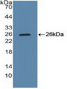 CCNB1 / Cyclin B1 Antibody - Western Blot; Sample: Recombinant CCNB, Human.