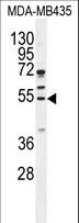 CCNB1 / Cyclin B1 Antibody - CCNB1 Antibody western blot of MDA-MB435 cell line lysates (35 ug/lane). The CCNB1 antibody detected the CCNB1 protein (arrow).