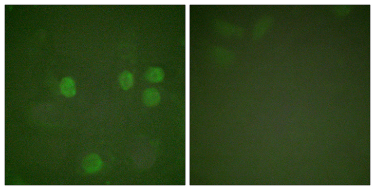 CCNB1 / Cyclin B1 Antibody - Immunofluorescence analysis of HeLa cells, using Cyclin B1 Antibody. The picture on the right is blocked with the synthesized peptide.