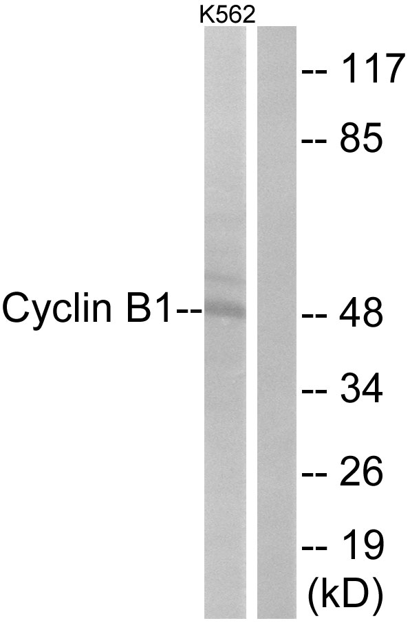 CCNB1 / Cyclin B1 Antibody - Western blot analysis of lysates from K562 cells, treated with serum 10% 15', using Cyclin B1 Antibody. The lane on the right is blocked with the synthesized peptide.