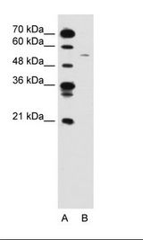 CCNB1 / Cyclin B1 Antibody - A: Marker, B: Jurkat Cell Lysate.  This image was taken for the unconjugated form of this product. Other forms have not been tested.